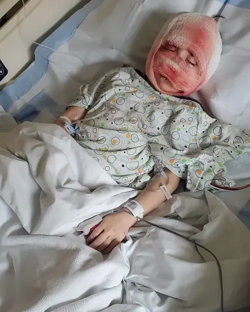 Ajude Bernardo a Recuperar Seu Sorriso