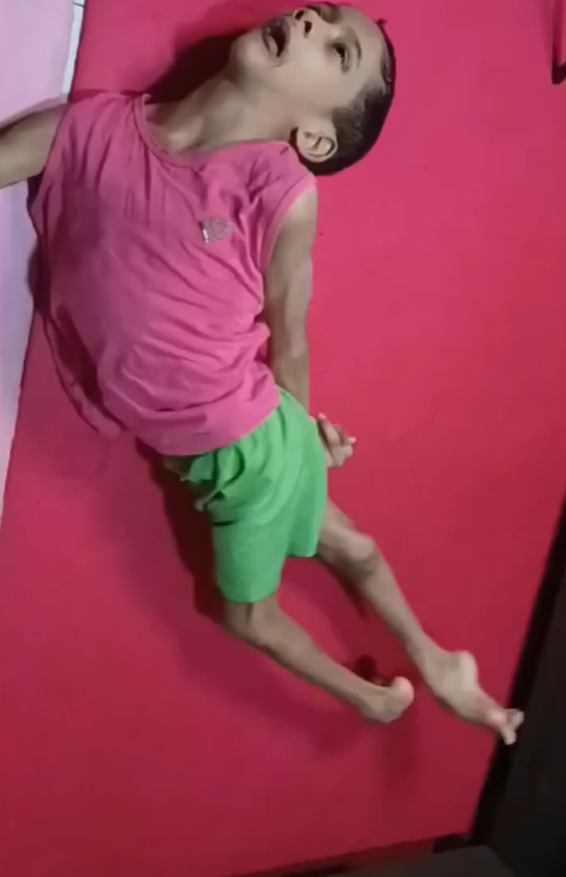 ⚠️ Luan precisa de ajuda urgente para aliviar dores causadas por uma doença rara